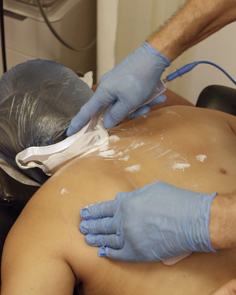 An MSK specialist applying therapeutic ultrasound to a patient's upper back with both hands gloved.
